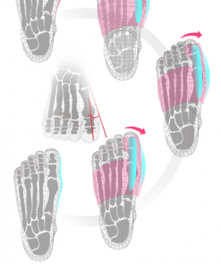 Best Orthopedic Bunion Corrector