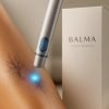 Blue Light Laser Pen for Spots, Scars & Tattoos