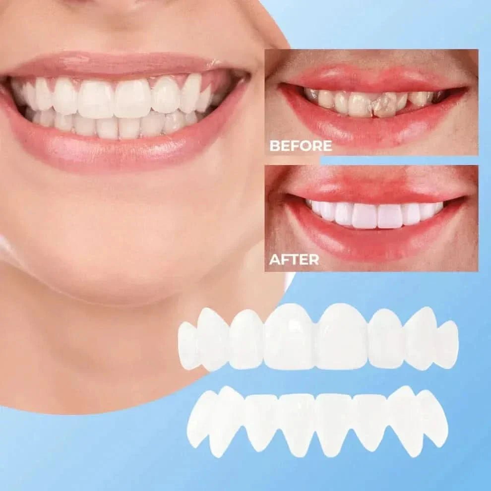 instant-smile-enhancer-clipon-4-osuefr.jpg